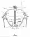 Fig. 04 - Head tracking frame for dental navigation