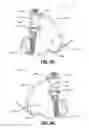 Fig. 05 - Head tracking frame for dental navigation
