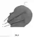 Fig. 09 - Head tracking frame for dental navigation