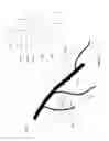 Fig. 19 - Scanned laser vein contrast enhancer utilizing surface topology