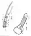 Fig. 31 - Scanned laser vein contrast enhancer utilizing surface topology