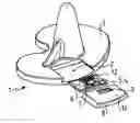 Fig. 01 - Prosthetic implant and method for the production of such an implant