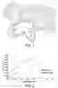 Fig. 02 - BONE IMPLANT
