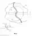 Fig. 08 - Suture management devices, methods, and systems