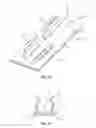 Fig. 09 - Suture management devices, methods, and systems