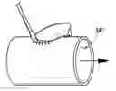 Fig. 01 - Device and method for assisting end-to-side anastomosis