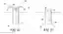 Fig. 06 - Device and method for assisting end-to-side anastomosis
