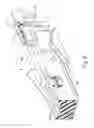 Fig. 07 - Features to align and close linear surgical stapler
