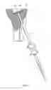 Fig. 08 - Retrograde resection apparatus and method