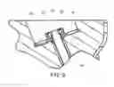 Fig. 09 - Retrograde resection apparatus and method