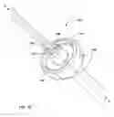 Fig. 13 - Retrograde resection apparatus and method