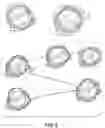 Fig. 05 - Devices and methods for a totally percutaneous collapsible aortic punch