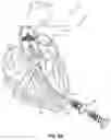 Fig. 06 - Devices and methods for a totally percutaneous collapsible aortic punch