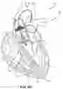 Fig. 07 - Devices and methods for a totally percutaneous collapsible aortic punch