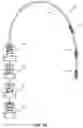 Fig. 10 - Devices and methods for a totally percutaneous collapsible aortic punch
