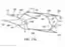 Fig. 46 - Clot retrieval system