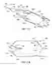 Fig. 48 - Clot retrieval system