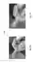 Fig. 09 - Surgical cannula and methods of use