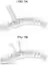 Fig. 07 - Methods for correction of spinal deformities