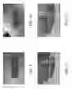 Fig. 09 - Methods and apparatus for controlled RF treatments and RF generator system