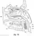 Fig. 06 - Devices for therapeutic nasal neuromodulation and associated methods and systems