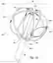 Fig. 11 - Devices for therapeutic nasal neuromodulation and associated methods and systems