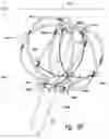 Fig. 14 - Devices for therapeutic nasal neuromodulation and associated methods and systems