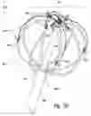 Fig. 15 - Devices for therapeutic nasal neuromodulation and associated methods and systems