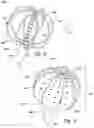 Fig. 19 - Devices for therapeutic nasal neuromodulation and associated methods and systems
