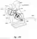 Fig. 21 - Devices for therapeutic nasal neuromodulation and associated methods and systems