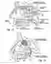 Fig. 02 - Devices for therapeutic nasal neuromodulation and associated methods and systems