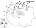 Fig. 01 - Cochlear implant localization system