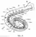 Fig. 04 - Cochlear implant localization system