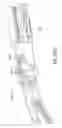 Fig. 48 - Surgical robot systems comprising robotic telemanipulators and integrated laparoscopy