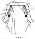 Fig. 08 - Removable and adjustable abutment devices and methods of operation thereof