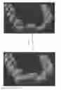 Fig. 01 - DENTAL APPLIANCE AND METHOD FOR MAKING