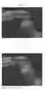 Fig. 06 - DENTAL APPLIANCE AND METHOD FOR MAKING