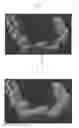 Fig. 07 - DENTAL APPLIANCE AND METHOD FOR MAKING