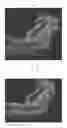 Fig. 08 - DENTAL APPLIANCE AND METHOD FOR MAKING