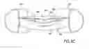 Fig. 08 - ACCOMMODATING INTRAOCULAR LENSES