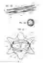 Fig. 03 - Rotation-based anchoring of an implant