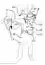 Fig. 01 - Force-balancing support, mechanical apparatus and wearable support device
