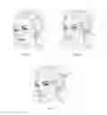 Fig. 07 - Personal care tool for cooling and treating skin