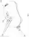 Fig. 04 - Apparatus for massaging human breast
