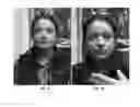 Fig. 02 - METHODS FOR ADMINISTRATION OF COSMETIC AND MEDICAL AGENTS