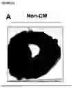 Fig. 02 - Therapeutic Compositions Comprising Mesenchymal Stem Cell Particles And Related Methods