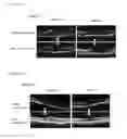 Fig. 02 - Agent for treating retinopathy