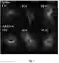 Fig. 04 - TREATMENT OF DISEASES MEDIATED BY VASCULAR HYPERPERMEABILITY
