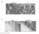 Fig. 01 - TREATMENT OF INFLAMMATORY BOWEL DISEASE