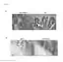 Fig. 02 - TREATMENT OF INFLAMMATORY BOWEL DISEASE